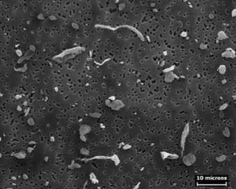 poumon-flock-disease-microscopie-electronique